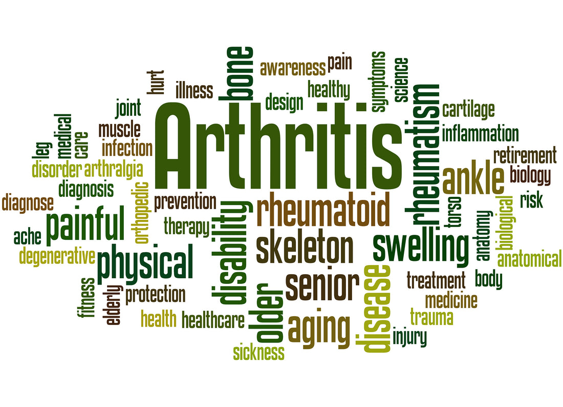 Ankle Arthritis Overview