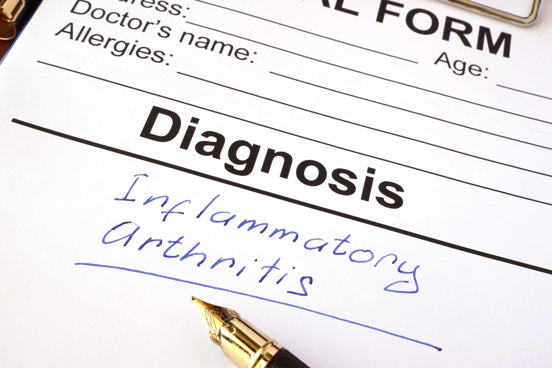 Arthritis in Back - Spinal Arthritis Overview
