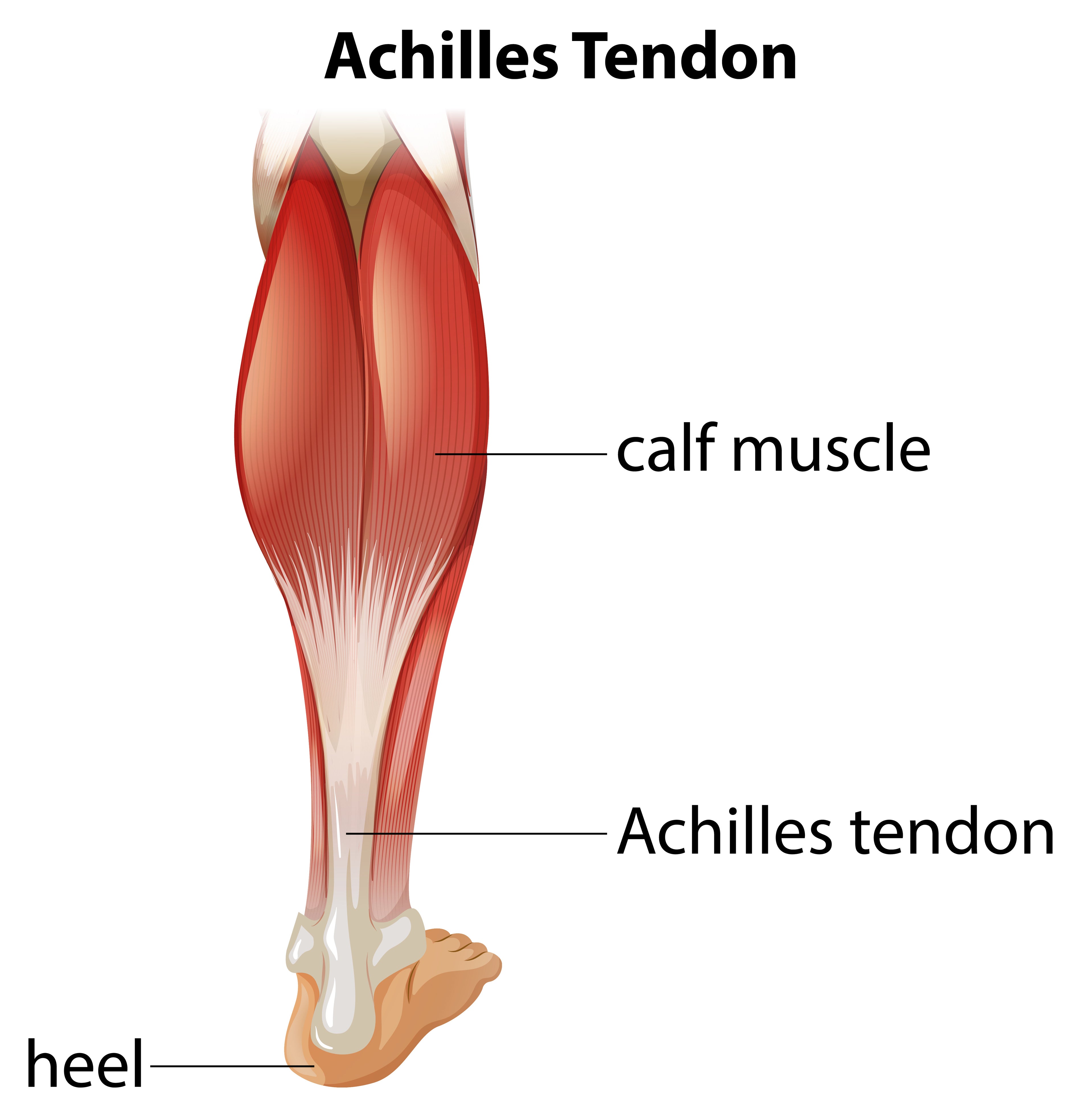 Achilles Tendon rupture ,tear, tendonitis - Everything You Need To Know -  Dr. Nabil Ebraheim - YouTube