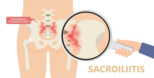 How to Find Relief for Sacroiliac (SI) Joint Pain