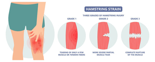 Pulled Hamstring Overview